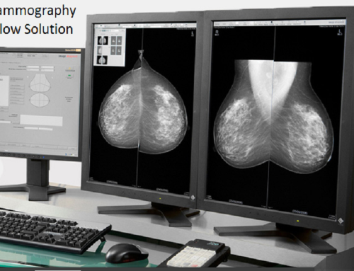 Mammography